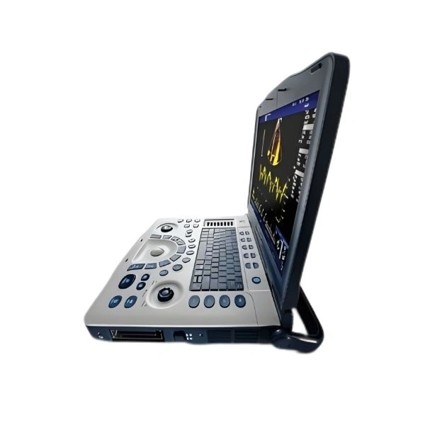 Buy Fujifilm SonoSite ZX Ultrasound Machine at Best Price | EquipMedy